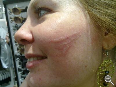 Klicka fÃ¶r stÃ¶rre